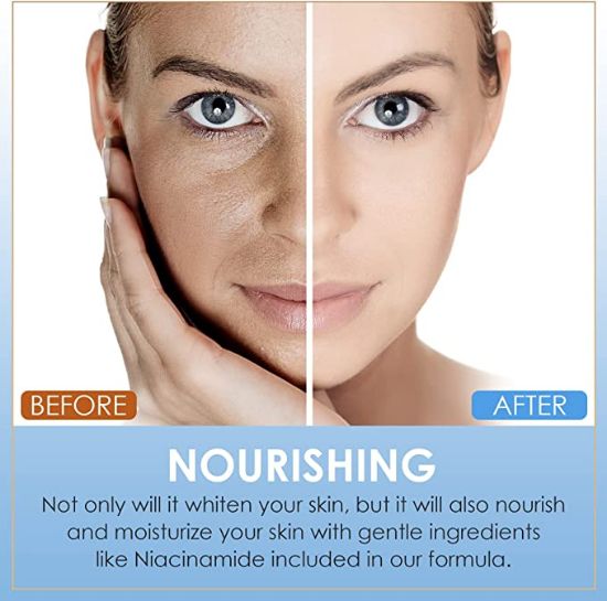 Your store. Skin-Whitening-Cream Face-and-Body-Lightening-Cream to ...