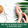 40% Urea Cream for Chapped Skin, Foot Cream & Hand Cream for Dry Thick Cracked Rough Skin, Callus Remover & Dead Skin Exfoliation